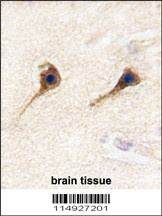 SARS2 Antibody