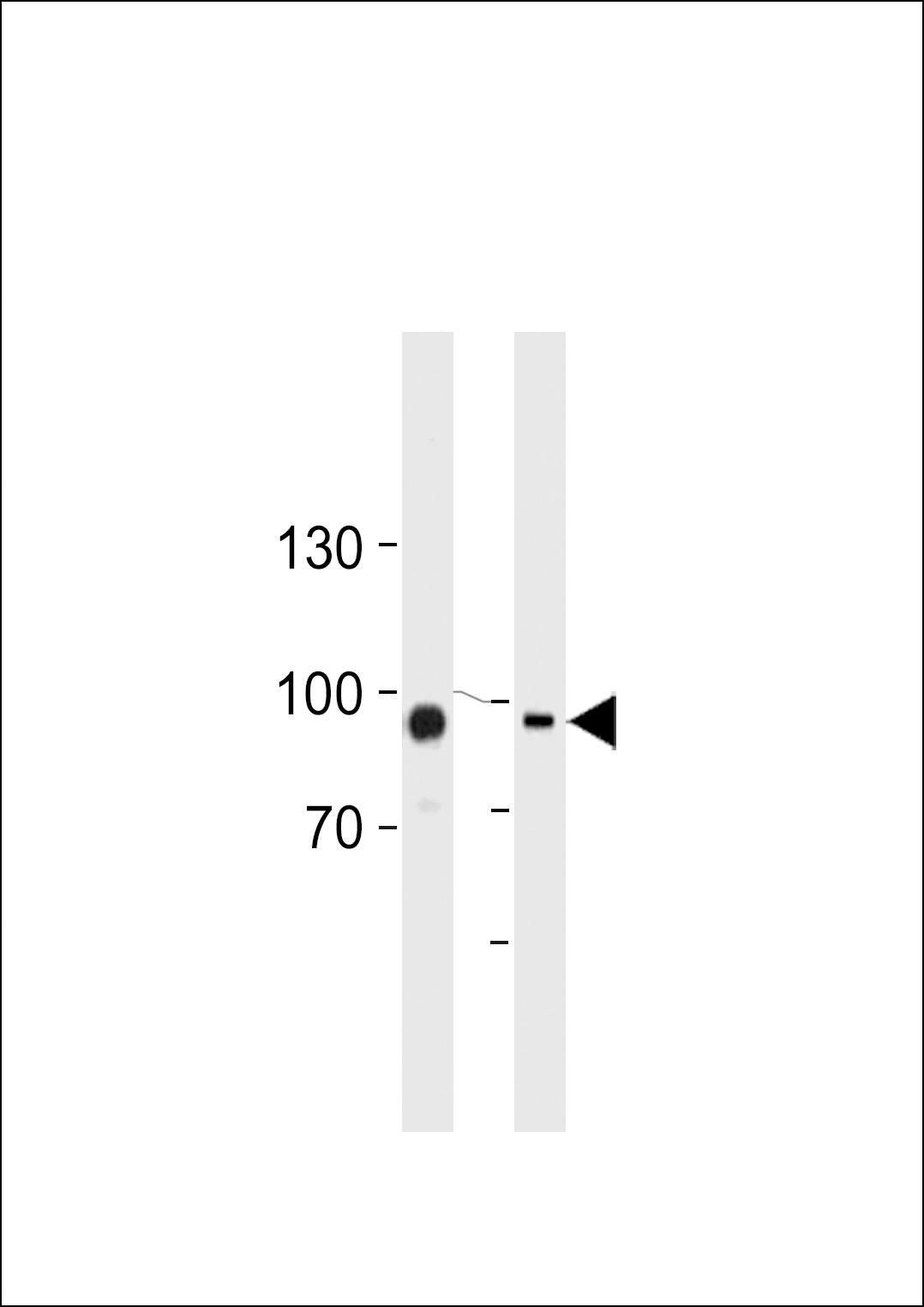 TGM2 Antibody