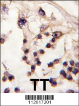 TESK2 Antibody