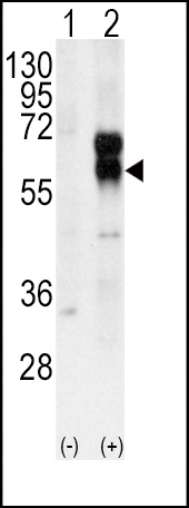 ACVRL1 Antibody