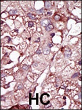 ACVRL1 Antibody