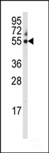 CYP3A5 Antibody