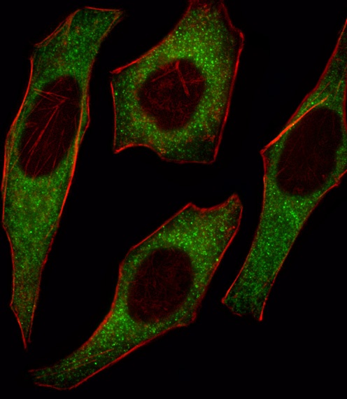 IRS2 Antibody