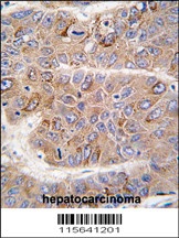 IRS2 Antibody