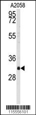 WBP2 Antibody