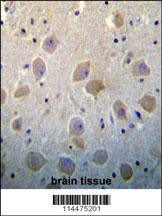 PTN Antibody