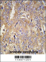 LTBP1 Antibody