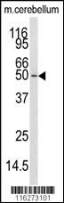 CAMKK1 Antibody