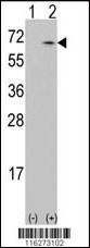 CAMKK1 Antibody