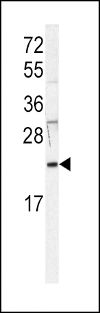 HRAS Antibody