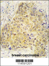 SEMA3A Antibody