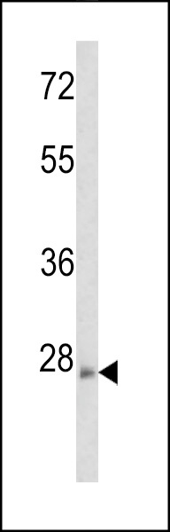 RND3 Antibody