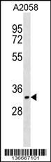 CDK5R1 Antibody