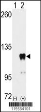 PUM2 Antibody