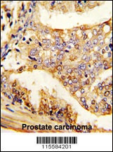 PUM2 Antibody