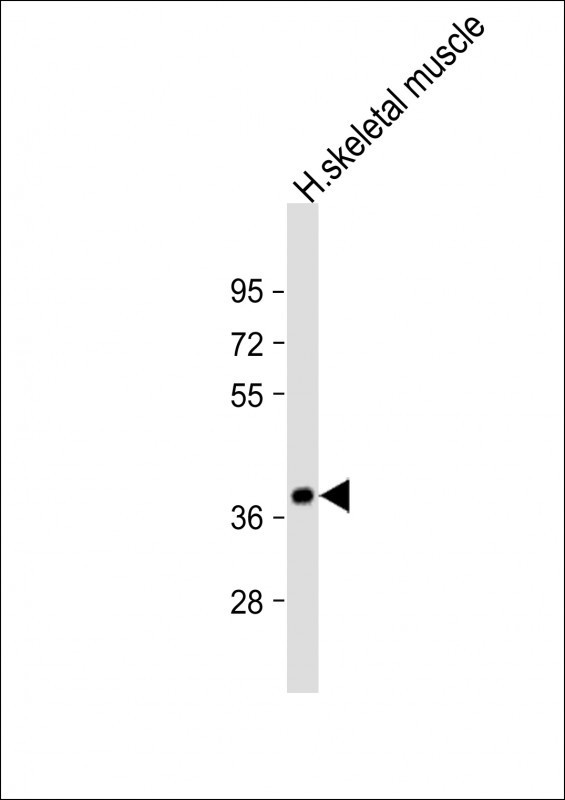 TRIB1 Antibody