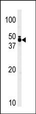 TRIB1 Antibody