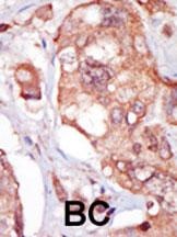 TNK1 Antibody