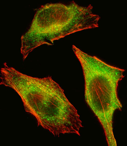 TEC Antibody