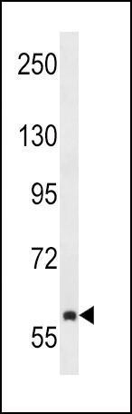 TEC Antibody