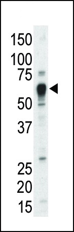 TEC Antibody