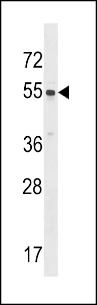 SRMS Antibody