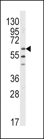 LYN Antibody