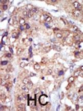 LYN Antibody