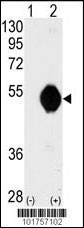 DOK2 Antibody