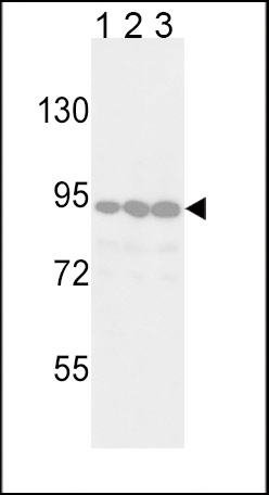 DDR2 Antibody