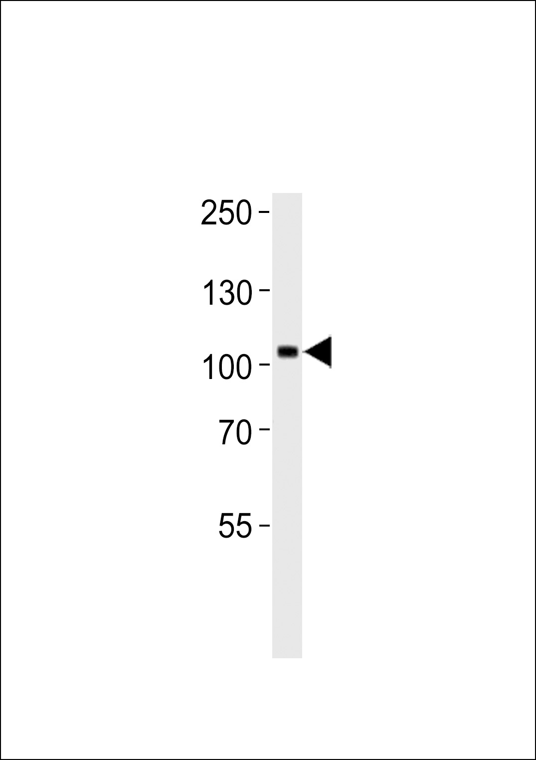 NTRK3 Antibody