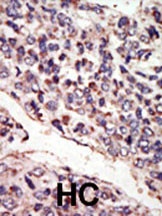 NTRK3 Antibody