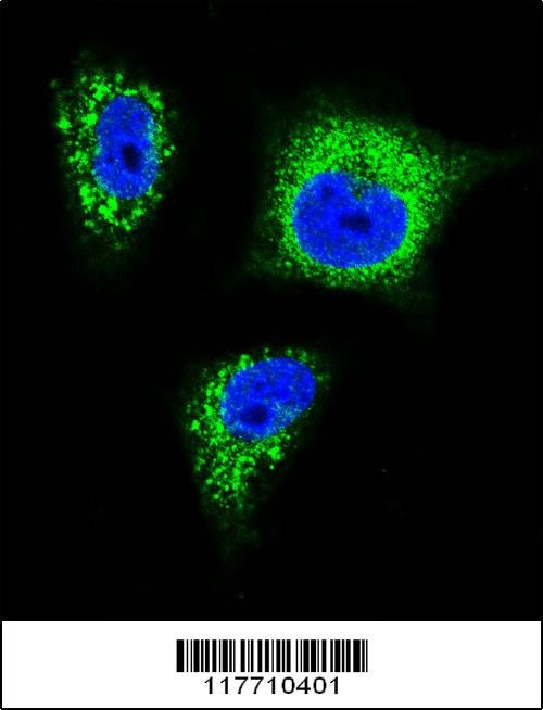 NTRK1 Antibody