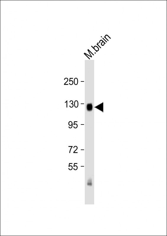 NTRK1 Antibody