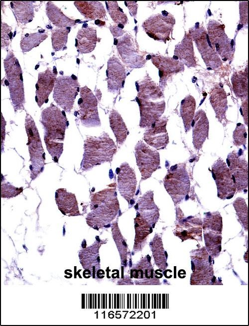 NTRK1 Antibody