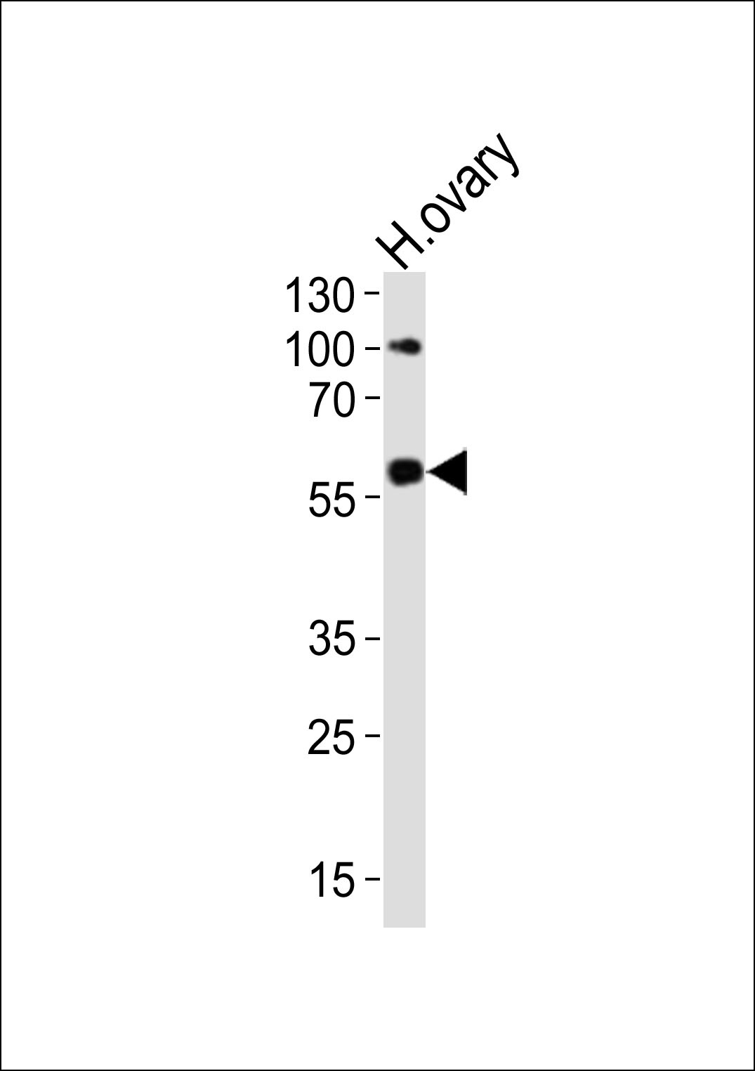 RYK Antibody