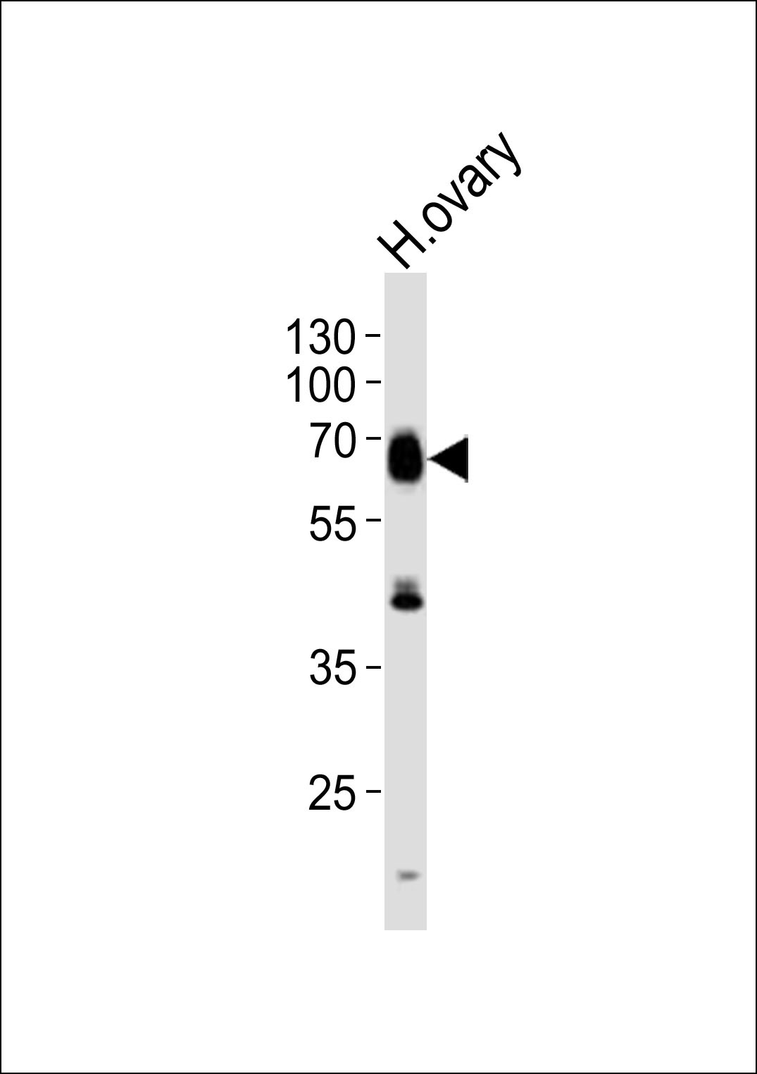 RYK Antibody