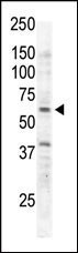 RYK Antibody