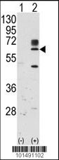 RYK Antibody