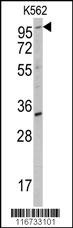 ROR2 Antibody