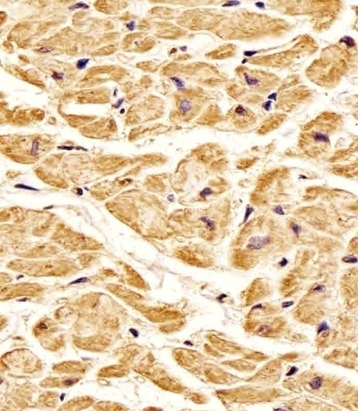 ROR1 Antibody