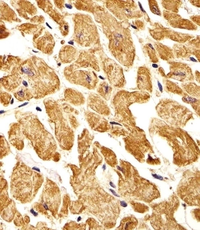 ROR1 Antibody