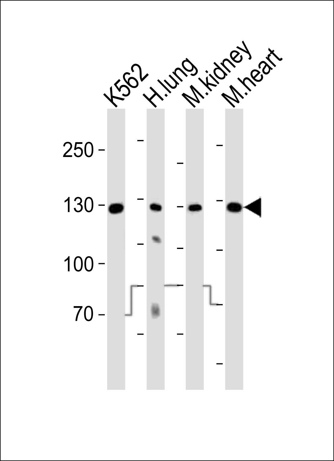 ROR1 Antibody