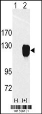 ROR1 Antibody