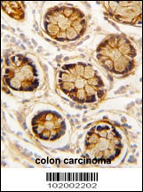 PDGFRL Antibody