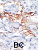 PDGFRL Antibody