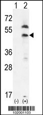 PDGFRL Antibody