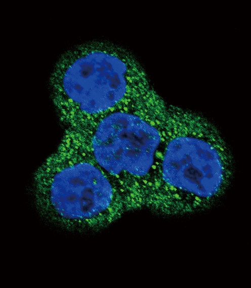 PDGFRB Antibody