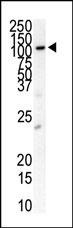 PDGFRB Antibody