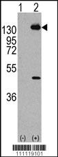 PDGFRA Antibody